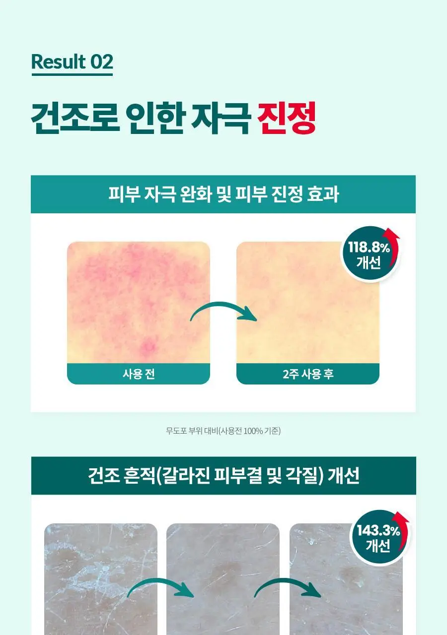 [진정보습] 닥터지 레드 블레미쉬 클리어 모이스처 토너 증정 기획 (토너 300ml+크림30ml) 상세페이지 18